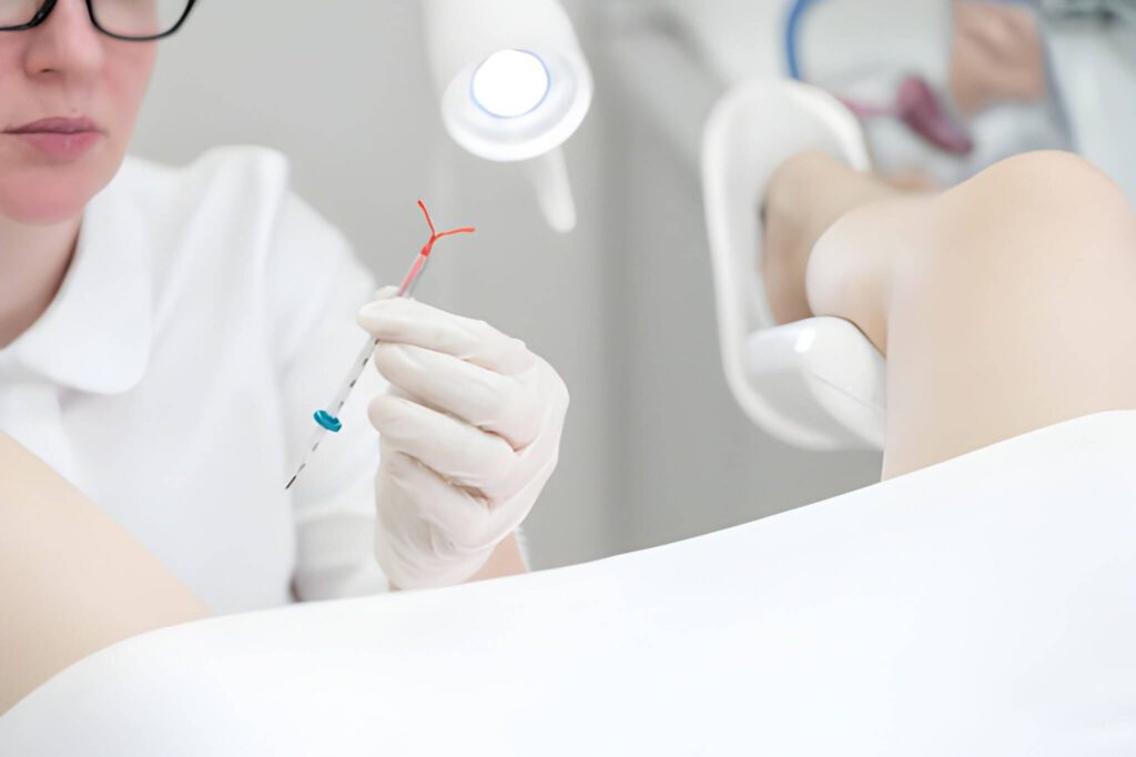 Bleeding for 2 Weeks After IUD Insertion What’s Normal